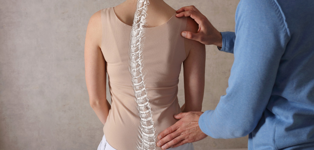 Scoliosis,Spine,Curve,Anatomy,,Posture,Correction.,Chiropractic,Treatment,,Back,Pain