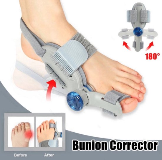 Hallux valgus corrector 6 Hallux valgus corrector